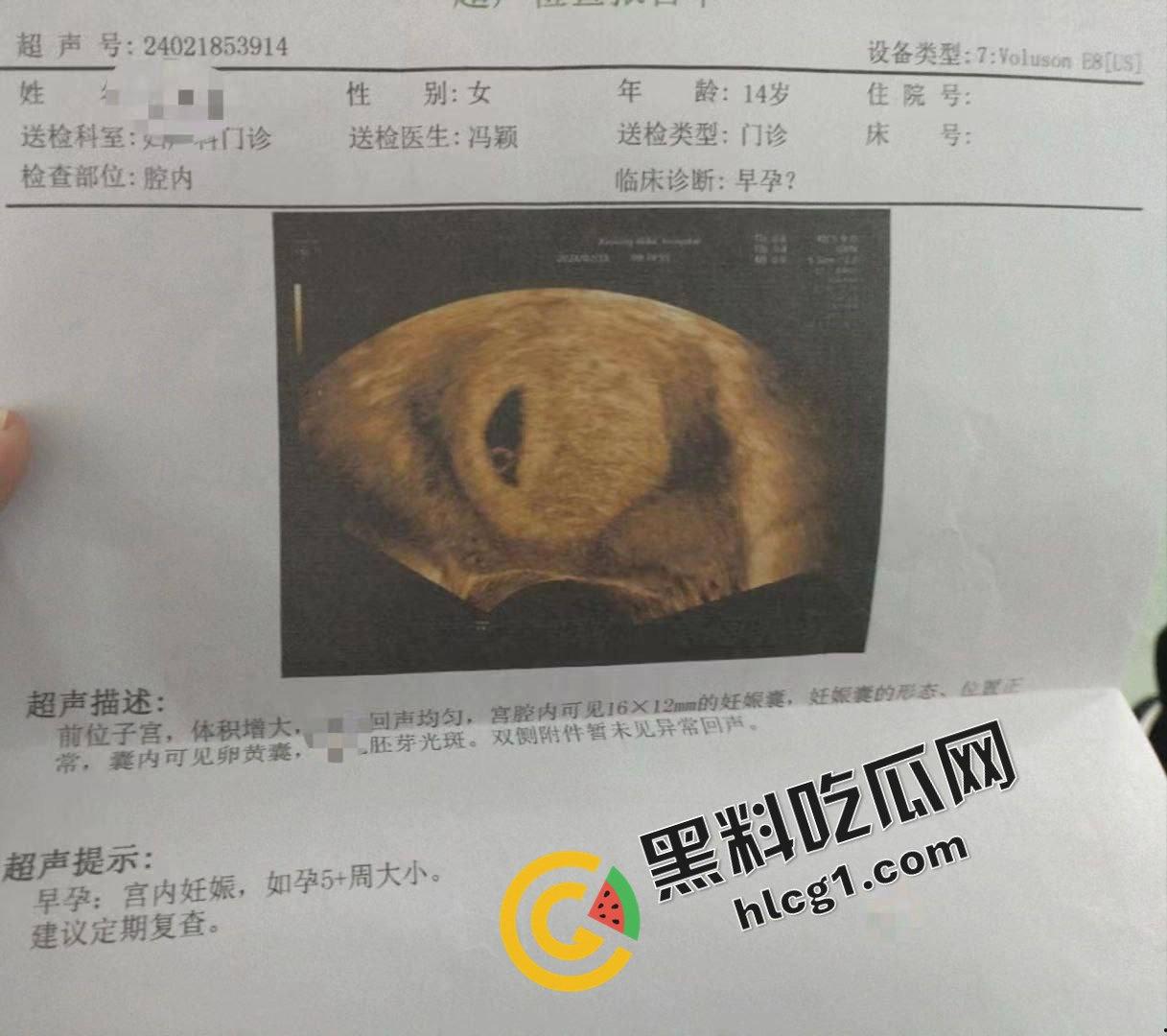 逆天事件！初中生14岁偷吃禁果 因为爽而不做措施无套内射 早孕发朋友圈炫耀-4